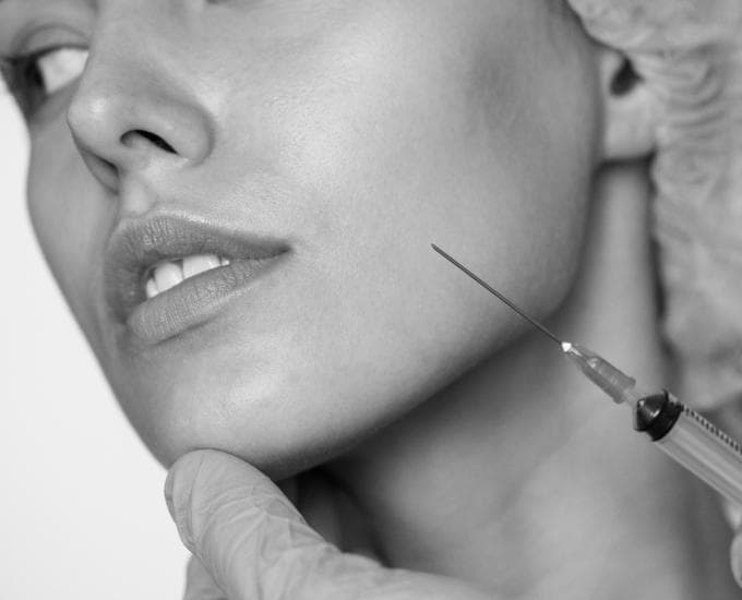 Dermal Fillers at Emertat Beauty Polyclinic